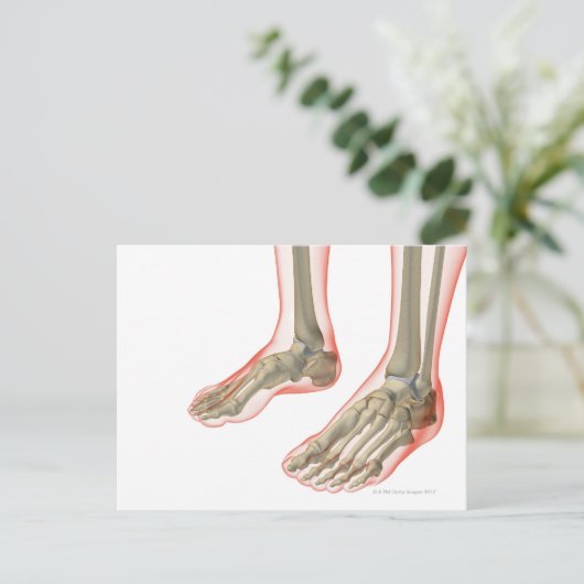 Botten van de Feet Briefkaart (Staand voorkant)