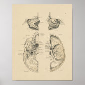  Botten van de Huid 1880 Afdrukken Poster (Voorkant)