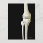 Botten van de knie 4 briefkaart (Voorkant)