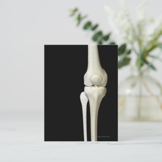 Botten van de knie 4 briefkaart (Staand voorkant)