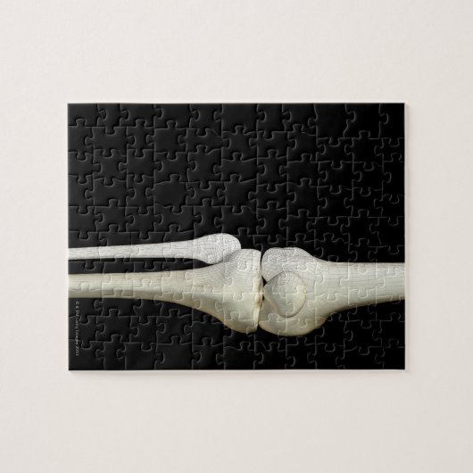 Botten van de knie 4 legpuzzel (Horizontaal)