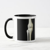 Botten van de knie 4 mok (Links)