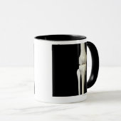 Botten van de knie 4 mok (Voorkant rechts)