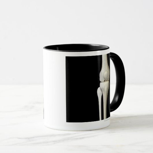 Botten van de knie 4 mok (Voorkant rechts)