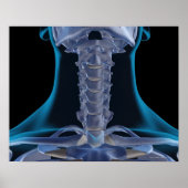 Botten van de nek 2 poster (Voorkant)