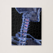 Botten van de nek 3 legpuzzel (Verticaal)