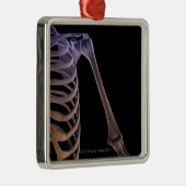 Botten van de schouder metalen ornament (Rechts)