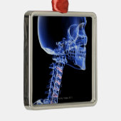 Botten van het hoofd en de nek metalen ornament (Rechts)