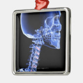 Botten van het hoofd en de nek metalen ornament (Links)