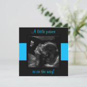 Boy Baby Gepersonaliseerd echografische fotosjablo Kaart (Staand voorkant)