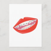 Braces Teeth Briefkaart (Voorkant)