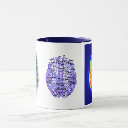 Brain afbeelding mok (Midden)