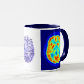 Brain afbeelding mok (Voorkant rechts)