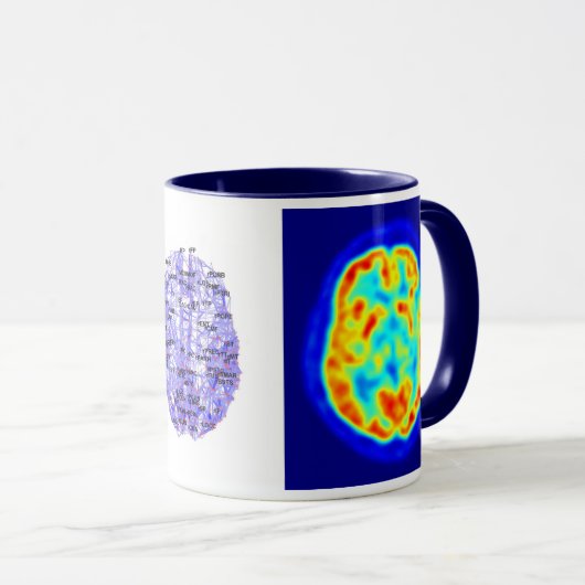 Brain afbeelding mok (Voorkant rechts)