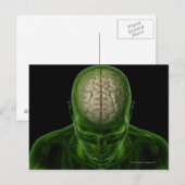 Brain Arteries Briefkaart (Voorkant / Achterkant)