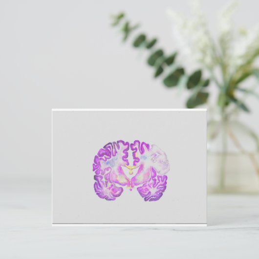 Brain Briefkaart (Staand voorkant)