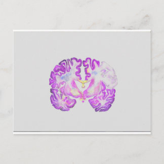 Brain Briefkaart