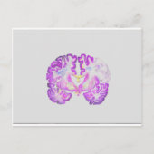 Brain Briefkaart (Voorkant)