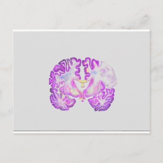 Brain Briefkaart (Voorkant)