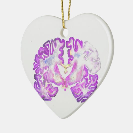 Brain Keramisch Ornament (Links)