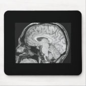 Brain MRI Muismat (Voorkant)