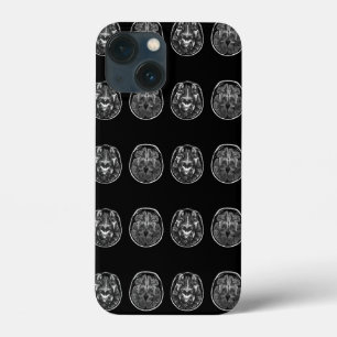 Brain mri scan Case-Mate iPhone case