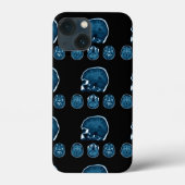 Brain Mri scan Case-Mate iPhone Case (Achterkant)