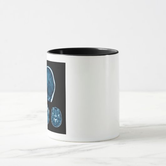 Brain Mri scan Mok (Midden)