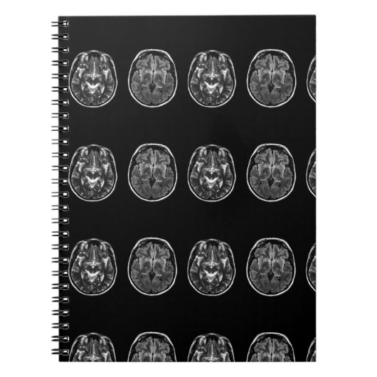 Brain mri scan notitieboek (Voorkant)