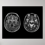 Brain mri scan poster (Voorkant)