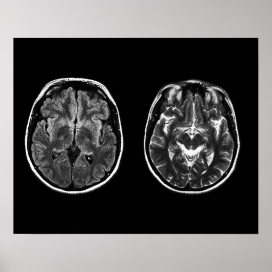 Brain mri scan poster (Voorkant)