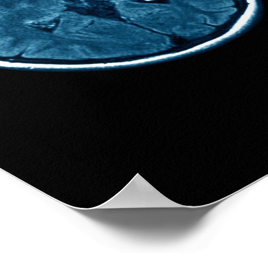 Brain Mri scan Poster (Hoek)