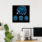 Brain Mri scan Poster (Thuiskantoor)