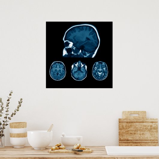 Brain Mri scan Poster (Keuken)