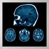 Brain Mri scan Poster (Voorkant)
