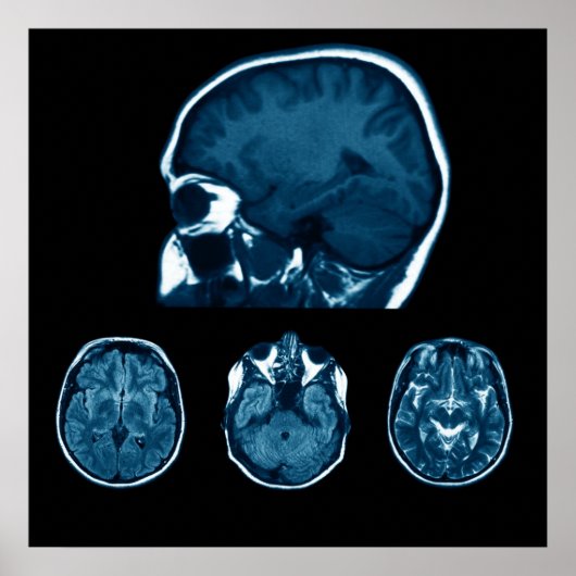 Brain Mri scan Poster (Voorkant)