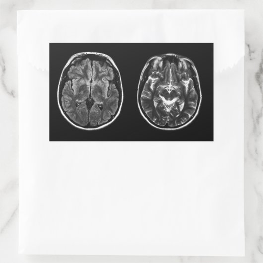 Brain mri scan rechthoekige sticker (Tas)