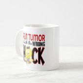 Brain Tumor met de verkeerde meid Koffiemok (Voorkant links)