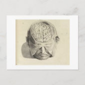 Brains Briefkaart (Voorkant)