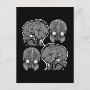BRAINS! (MRI) BRIEFKAART