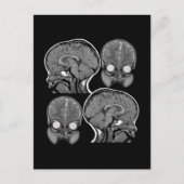 BRAINS! (MRI) BRIEFKAART (Voorkant)