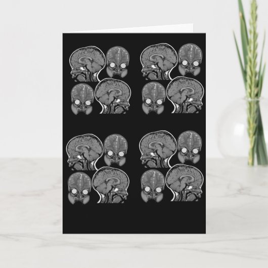 BRAINS! MRI KAART (Voorkant)