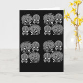 BRAINS! MRI KAART (Gele Bloem)