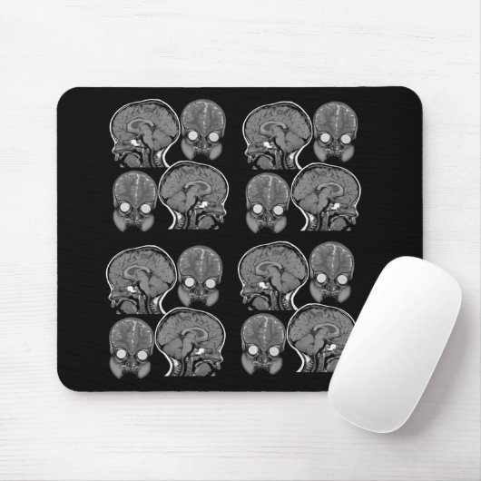 BRAINS! (MRI) MUISMAT (Met muis)