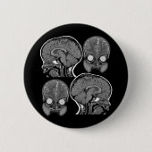 BRAINS! (MRI) RONDE BUTTON 5,7 CM (Voorkant)