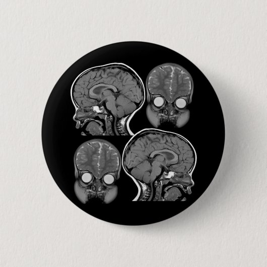 BRAINS! (MRI) RONDE BUTTON 5,7 CM (Voorkant)