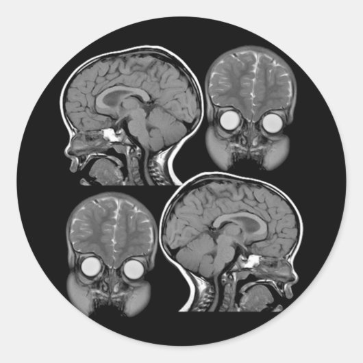 BRAINS! MRI RONDE STICKER (Voorkant)