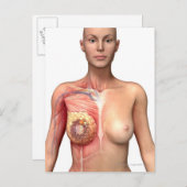 Breedkanker Briefkaart (Voorkant / Achterkant)