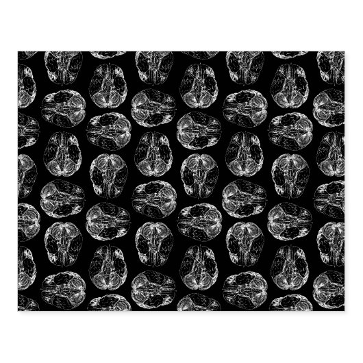 breindiagram Afdrukpatroon Afdrukpatronen Zwart Rubberstempel (Afrduk)