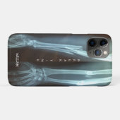 Breuken Radius en Ulna Xray "Pauze tijd"    Case-Mate iPhone Case (Achterkant (horizontaal))